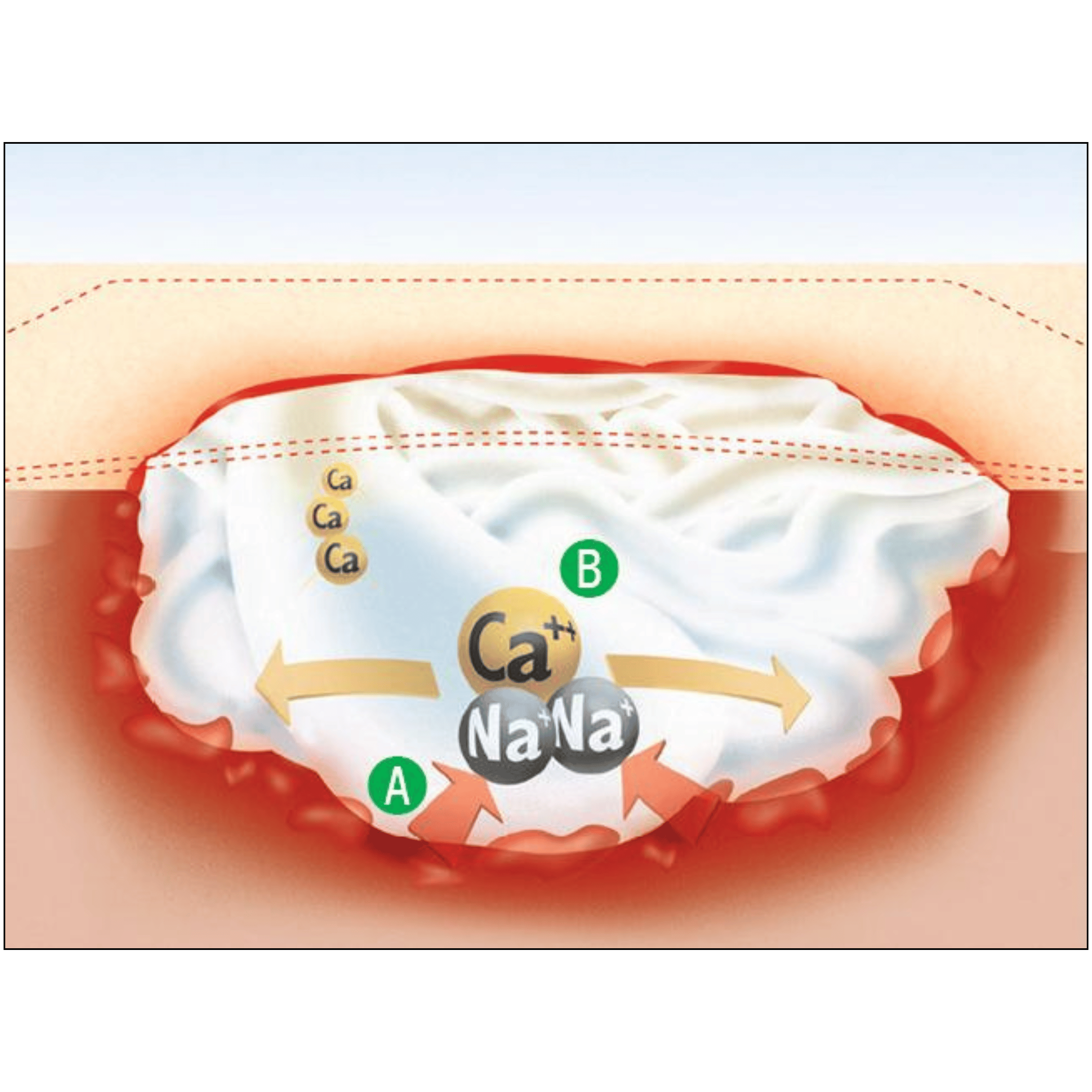 Opatrunek z alginianem Suprasorb A 